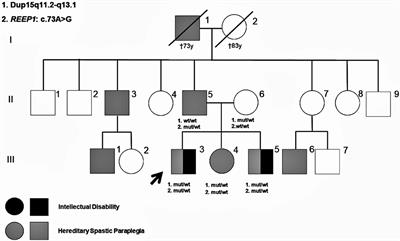 Hereditary Spastic Paraplegia and Intellectual Disability: Clinicogenetic Lessons From a Family Suggesting a Dual Genetics Diagnosis